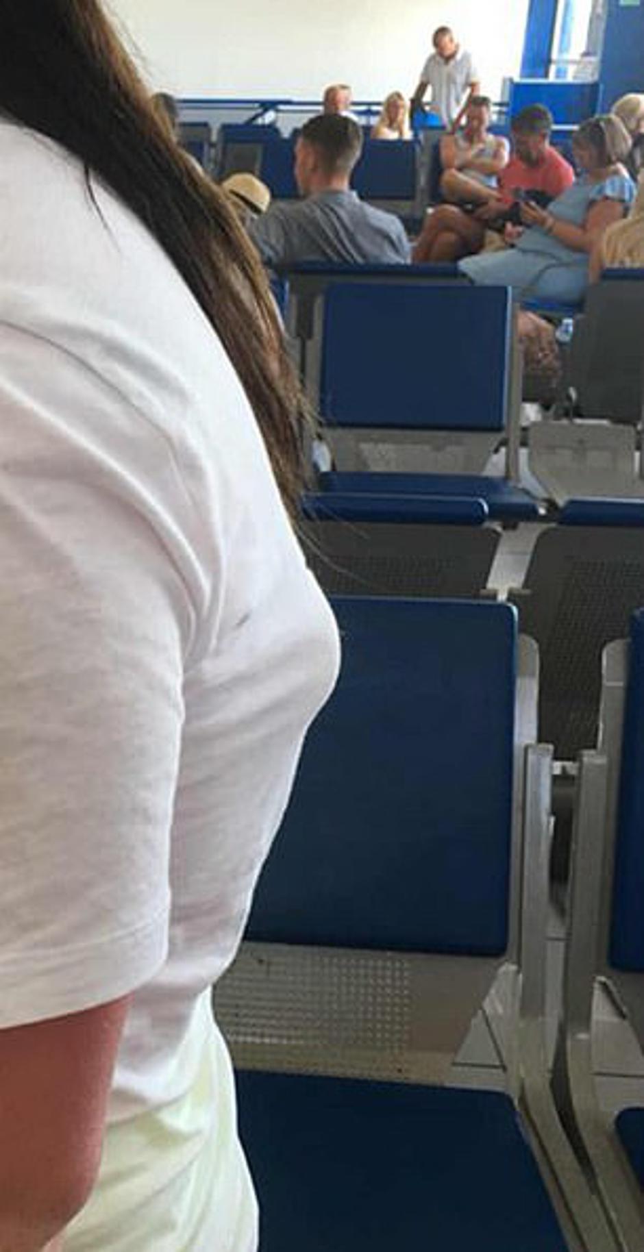 Opekline | Avtor: Facebook