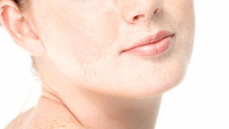 Če na koži opazite kakršnekoli spremembe, se o njih posvetujte z zdravnikom.