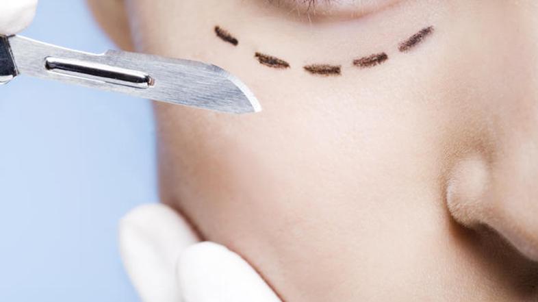 Vas motijo podočnjaki? (Foto: Shutterstock)