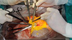 Varuhinja predlaga razmislek o načinu obveščanja o možnosti nasprotovanja darova