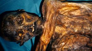 Ötzi, "ledeni človek"
