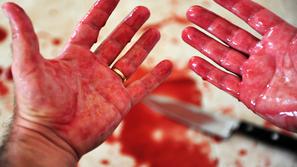 Okrvavljene roke