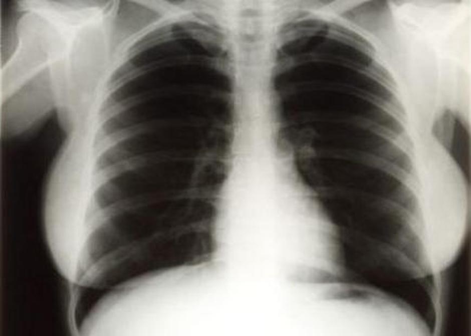 Rentgenske fotografije so prodali za veliko več denarja, kot so predvidevali. (F | Avtor: Žurnal24 main