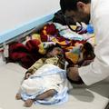 Kolera v Jemnu