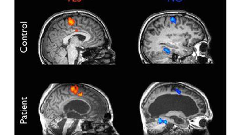 29-letniku so se ob misli na različne odgovore aktivirali različni predeli možga