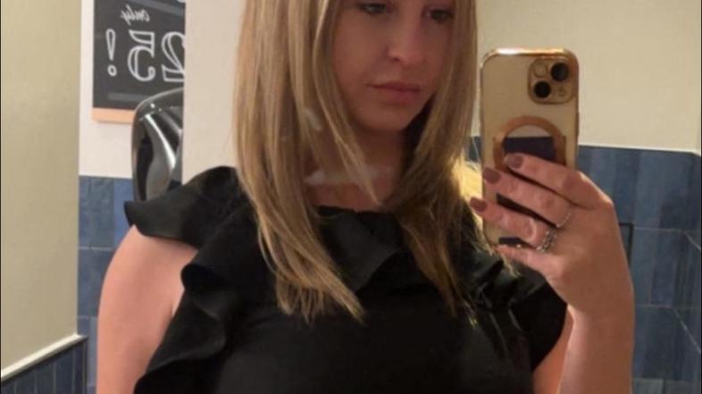 Charlie Sugden pred liposukcijo