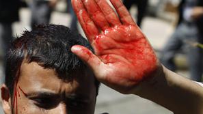 Jemen zadnje tedne pretresajo protesti nezadovoljnih državljanov, ki zahtevajo s