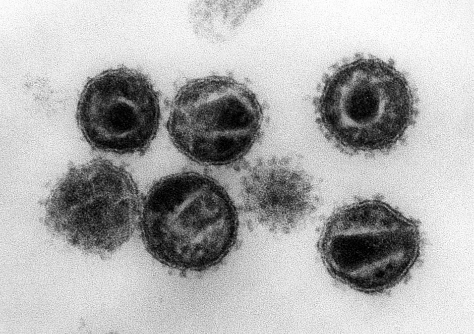 Z elektronskim mikroskopom 240.000-krat povečana slika virusa HIV, povzročitelja | Avtor: EPA