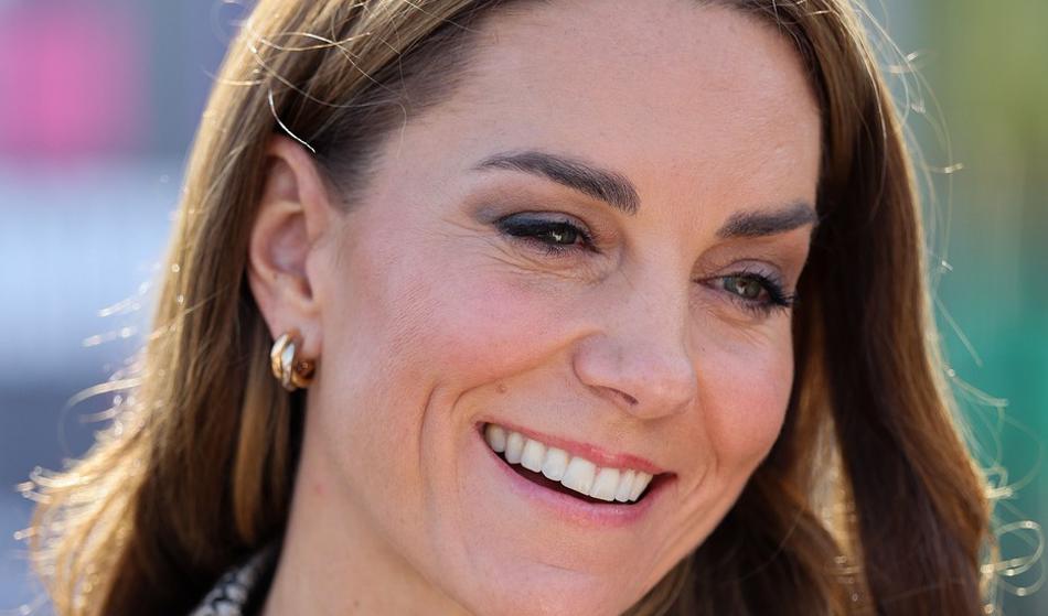 Princesa Kate ima nove zobe