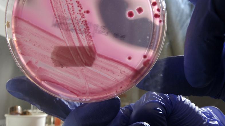 Američani so prepričani, da so superbakterijo vzgojili v laboratoriju in jo name