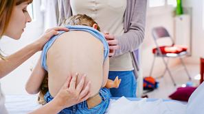 otrok zdravnik hrbtenica