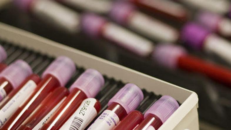 Francoska protidopinška agencija obljublja, da bo letos dobila prav vse kršitelj