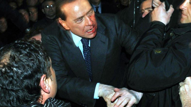 Berlusconi je moral zaradi poškodb po napadu s kipcem milanske katedrale na oper