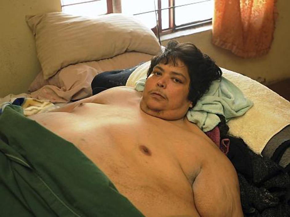 Jose Luis Garza je imel od nekdaj težave s prehranjevanjem.