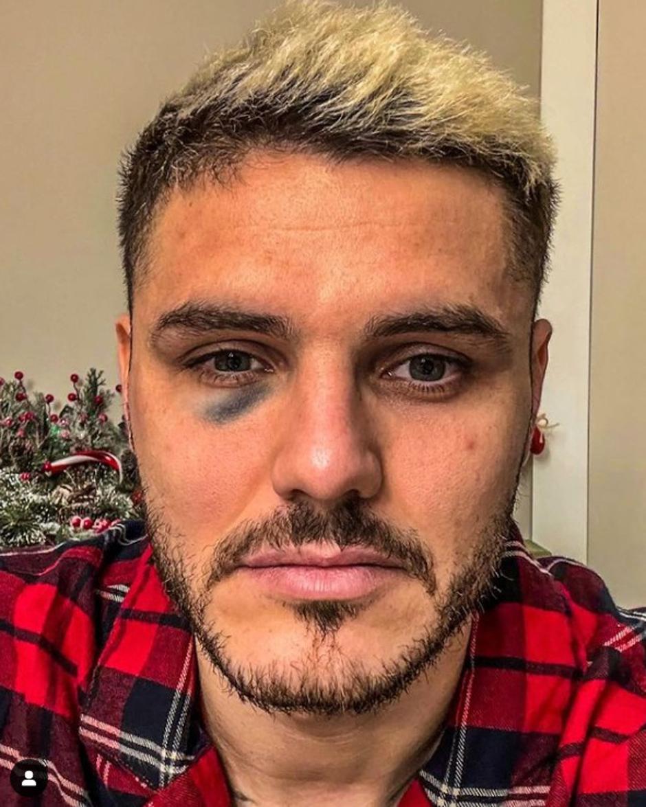 Icardi | Avtor: Instagram