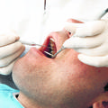 Ko so pred dvema letoma ostali brez ortodonta, je bila ena izmed predlaganih reš