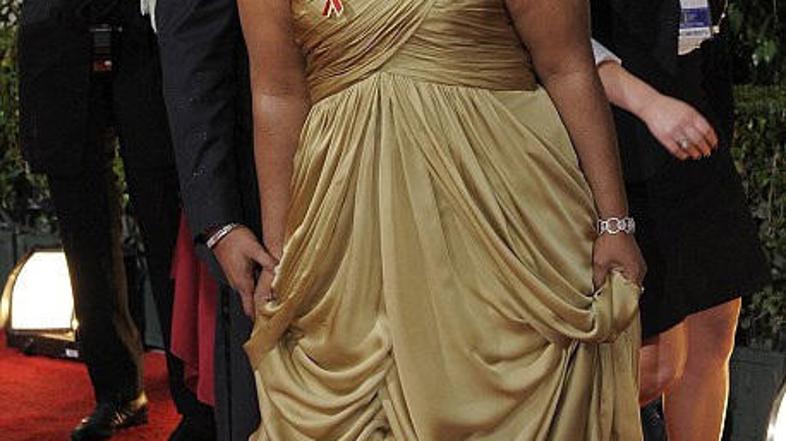 42-letna igralka je imela nohte na nogah neverjetno urejene, a je zanemarila pre