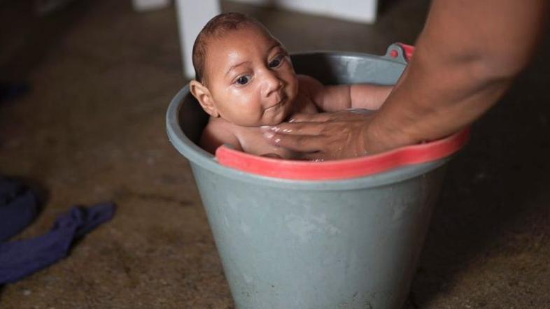 Zika, otrok
