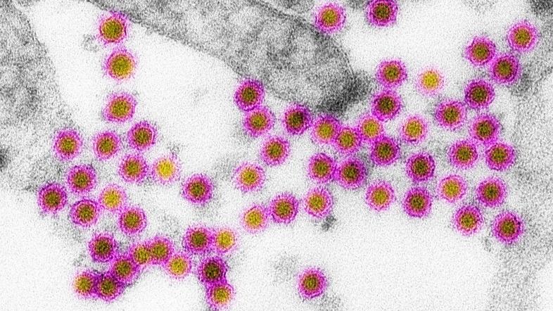 West Nile virus, bolezen zahodnega Nila