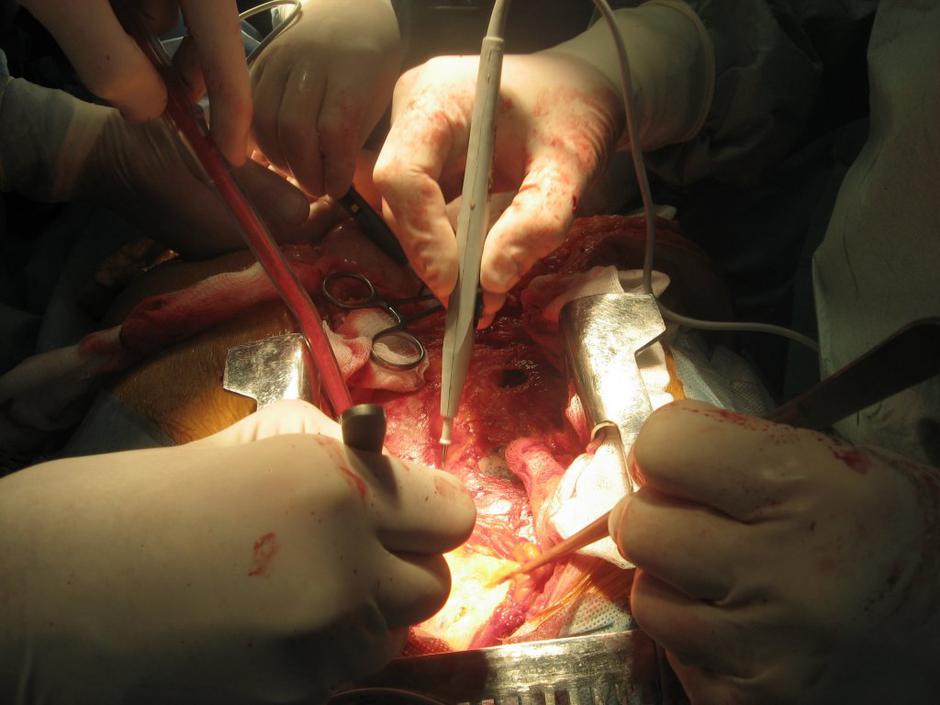 Operacija | Avtor: Shutterstock