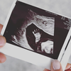 Aksel Lund Svindal ultrazvok dojenček