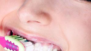 Pokazalo se je, da zobje bistveno vplivajo na naš spomin. (Foto: Shutterstock)