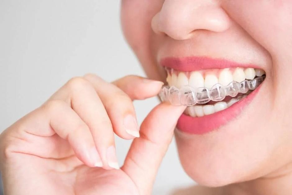 invisalign, zobje, estetetika, zdravje | Avtor: Invisalign