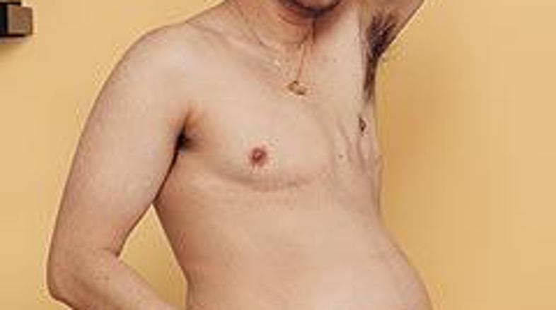 Beatie je takole poziral v prvi nosečnosti. Hčerki Susan se bo junija pridružil 