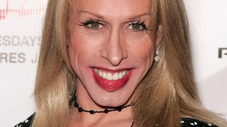 Alexis Arquette