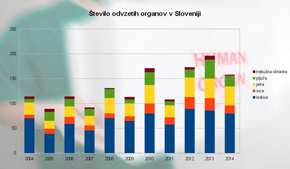 Darovanje organov | Avtor: Žurnal24/Slovenija Transplant