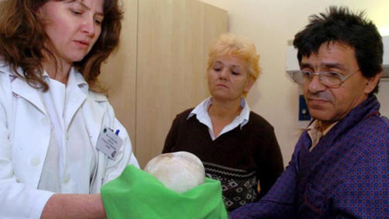 Urologinja Judit Csorba je Sandorju pokazala njegov kamen.