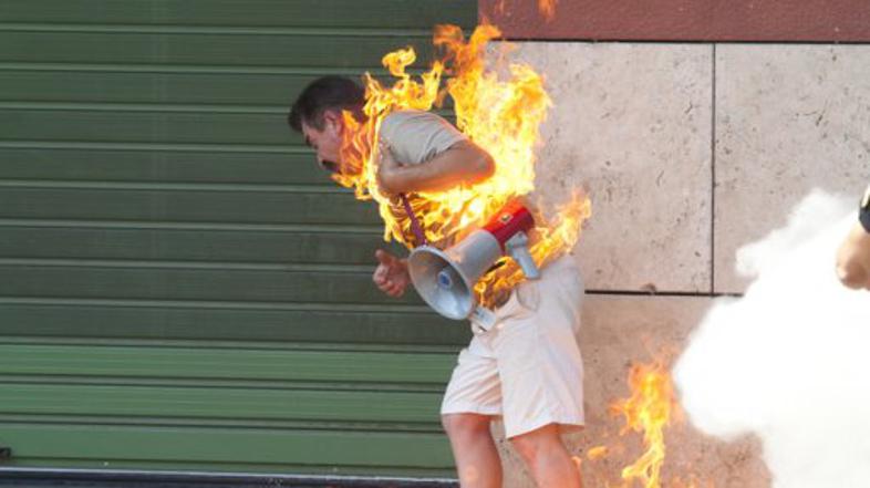 Samozažig. Slika je simbolična