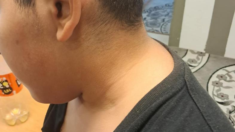 Napad na romskega otroka