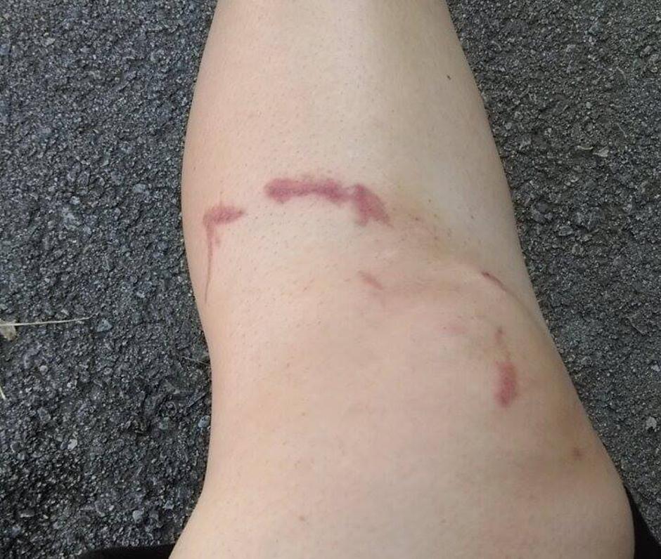 noga | Avtor: M. Š. 