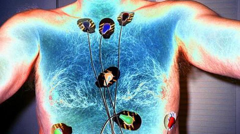 Z umetno hipotermijo rešimo šestino pacientov, ki doživijo infarkt, pravi Böttig