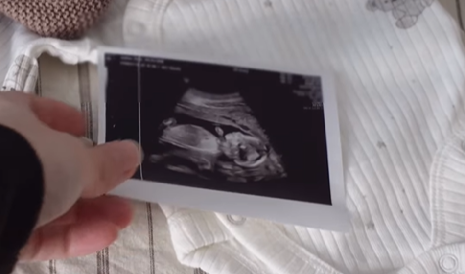 Ta znana Slovenka pričakuje prvega otroka!