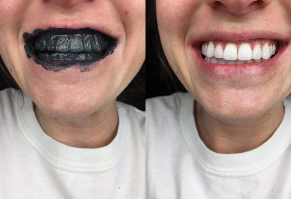 bio2you | Avtor: BIo2You