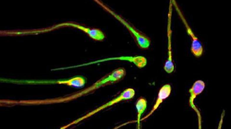 Posel s semensko tekočino cveti.