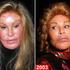 Jocelyn Wildenstein
