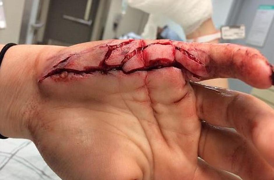 Poškodbe z blenderjem Kourtni Beebe | Avtor: Facebook