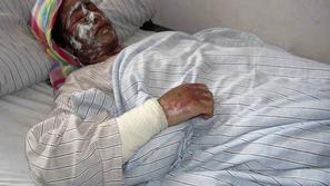 dekle, polito s kislino