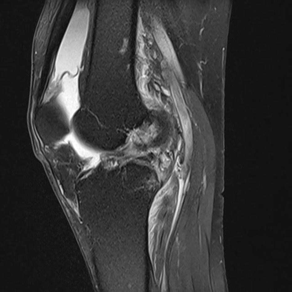 koleno | Avtor: Facebook