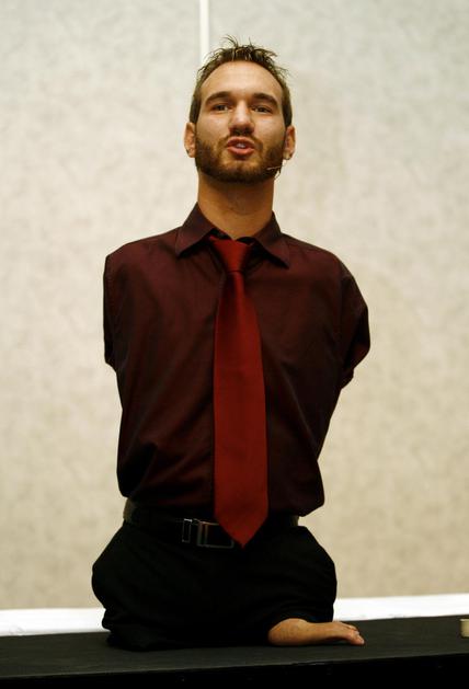 Nick Vujicic je sin srbskih staršev, ki so odšli na delo v Avstralijo. Med držav