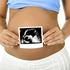 nosečnost, nosečnica, ultrazvok