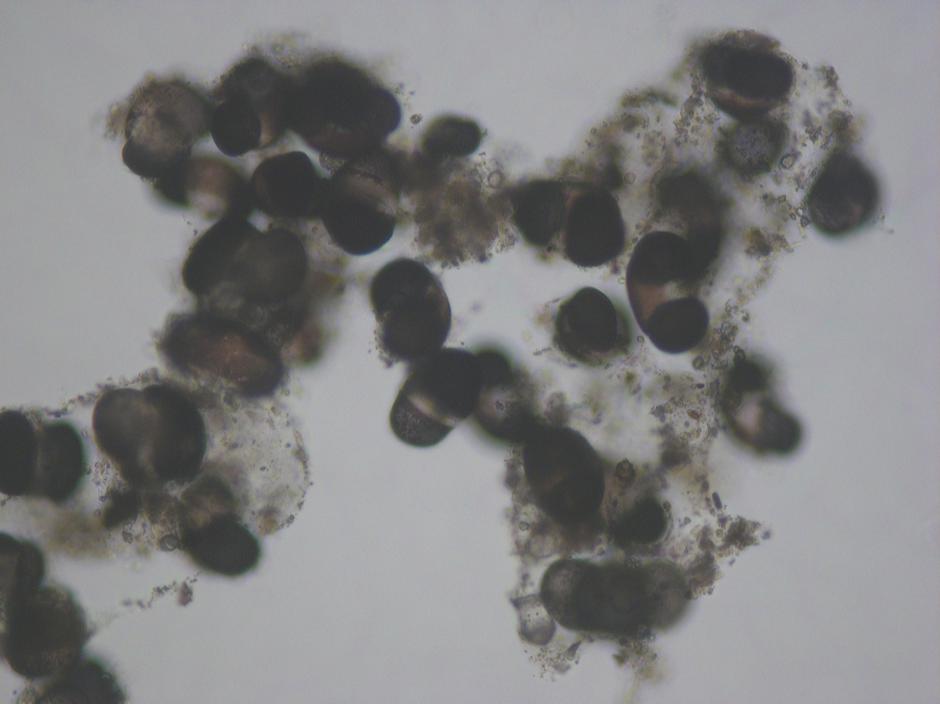 Mikroskopski posnetki | Avtor: Petra Slavinec