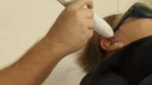 Laserska akupunktura