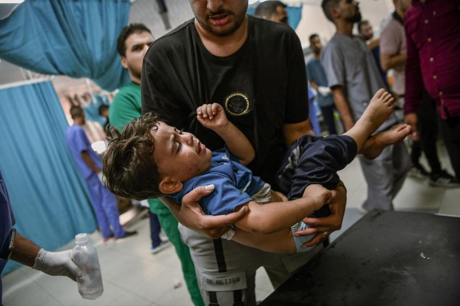 ranjen palestinski otrok | Avtor: Profimedia