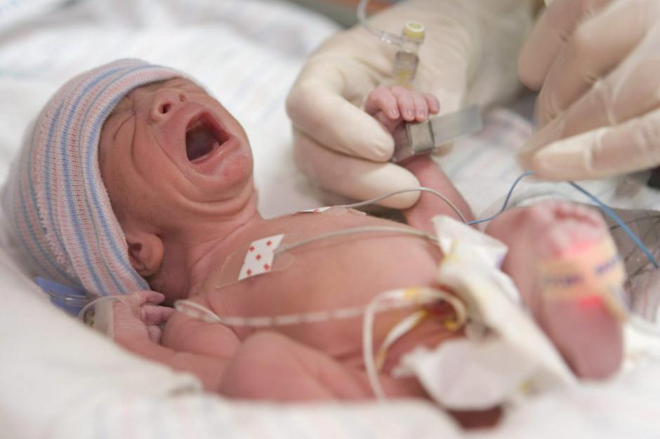 Novorojenček | Avtor: EPA
