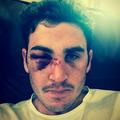 Craig Kieswetter
