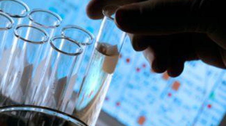 Preventivni pregledi lahko rešijo življenje.